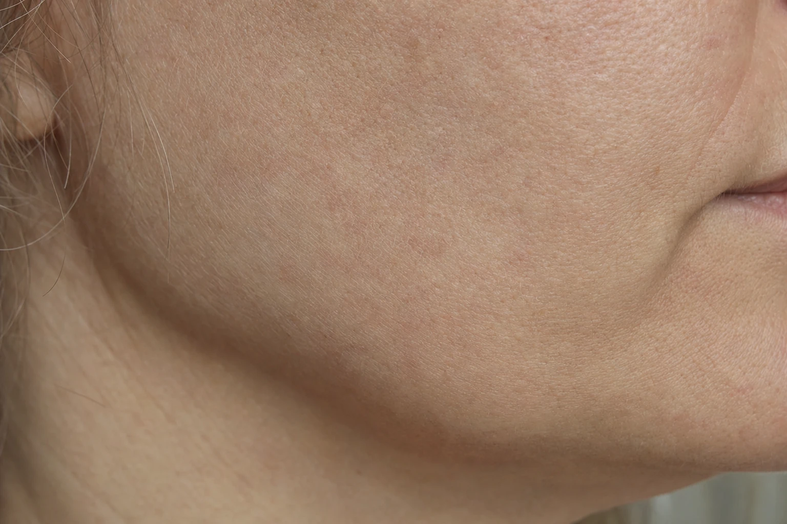 Close-up of the skin on a fictional woman's cheek and jaw: pores and fine lines visible in soft light, showing the texture of living skin.