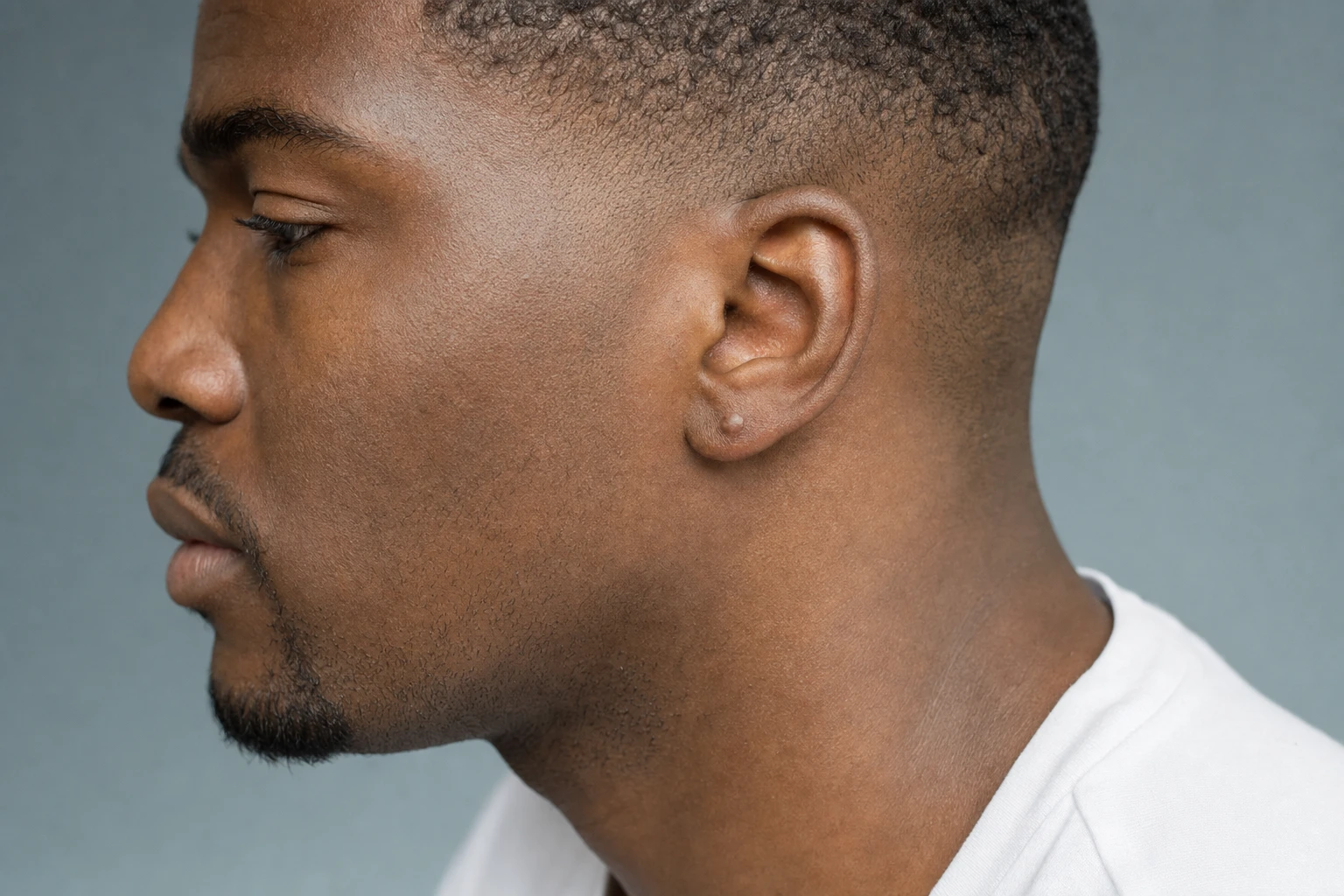 Side profile of a dark-skinned man with a small, round raised scar on his earlobe.