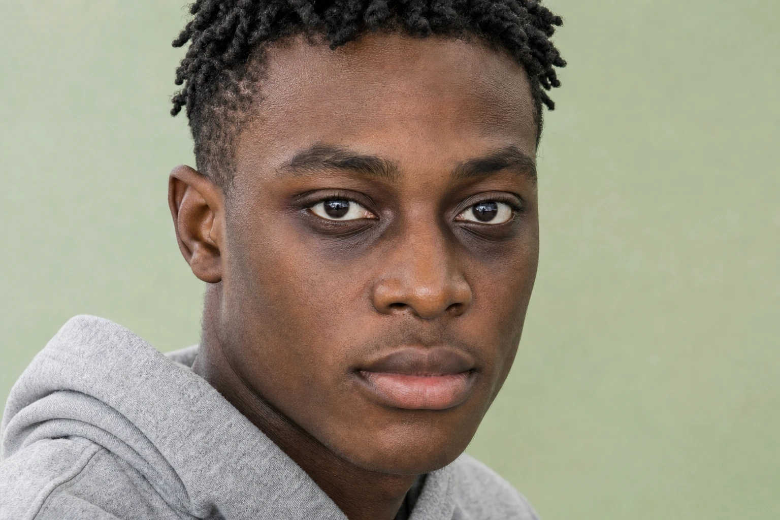 Face of a young Black man with darker coloration beneath both eyes.