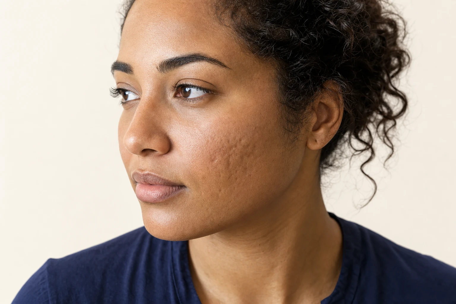 Three-quarter view of the cheek of a woman with caramel-toned skin, showing small, subtle indentations and natural skin texture.