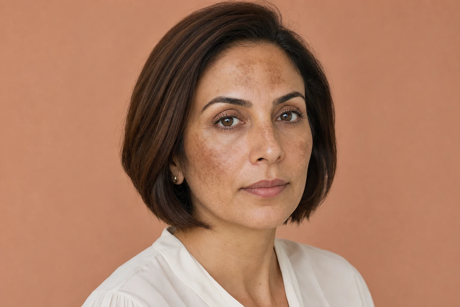 Three-quarter portrait of a woman with flat brown patches on her cheekbones and forehead.