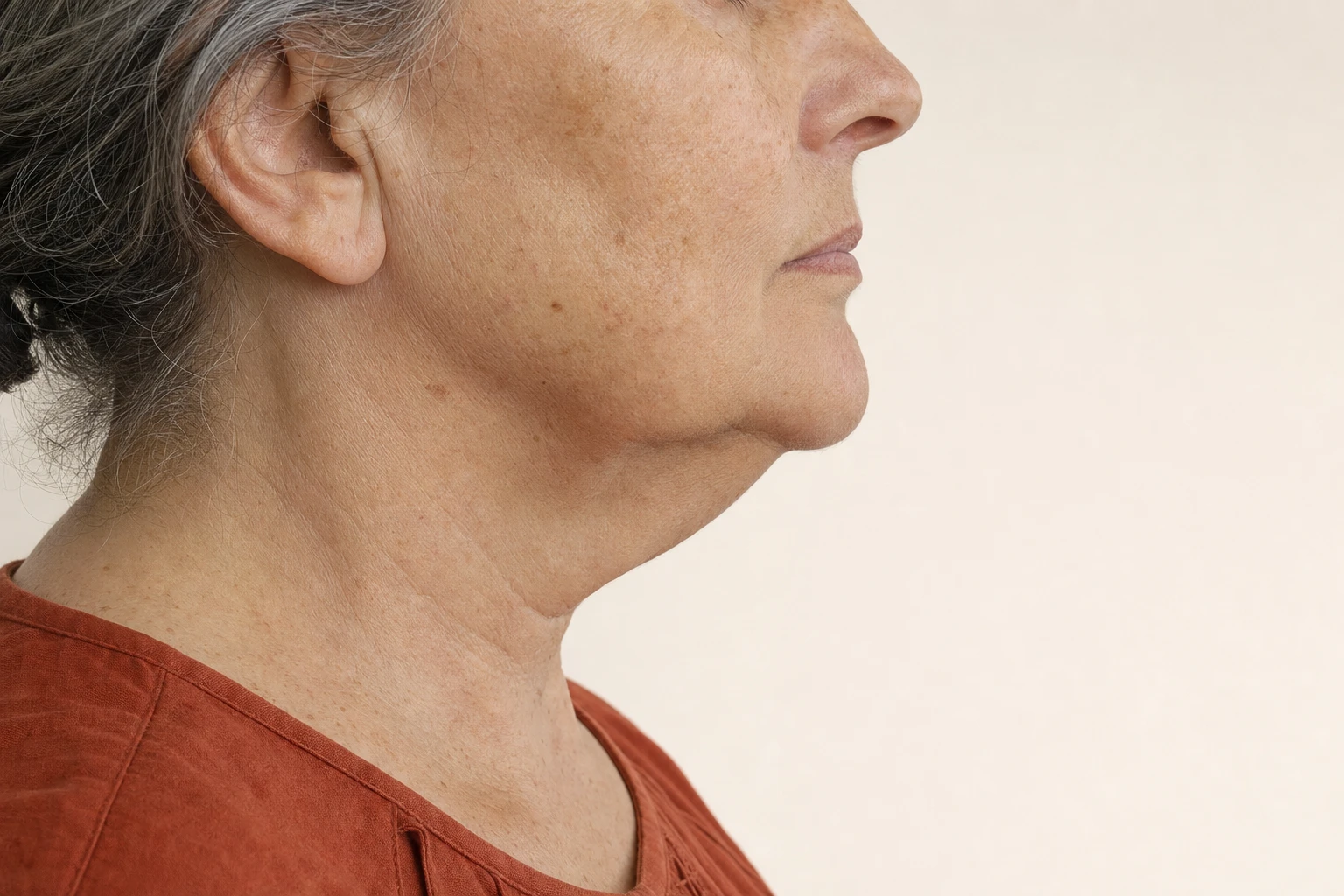 Side profile of an older woman's lower face, showing the jawline and the area beneath the chin at rest.